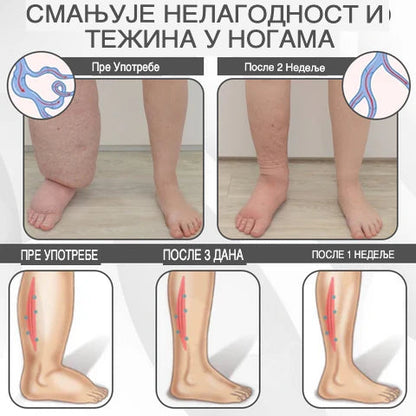 EdemaRelief Limfna Detox Krema