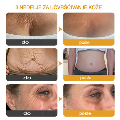 Botox Krema za Učvršćivanje i Smanjenje Bora