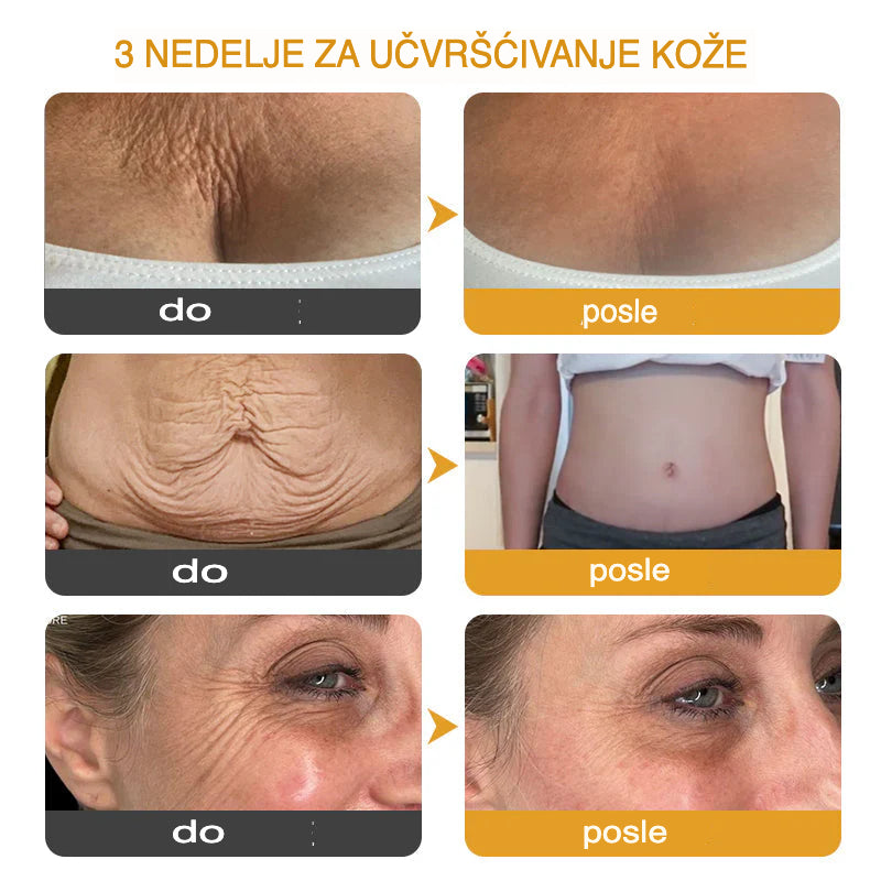 Botox Krema za Učvršćivanje i Smanjenje Bora – Višenamenska Krema