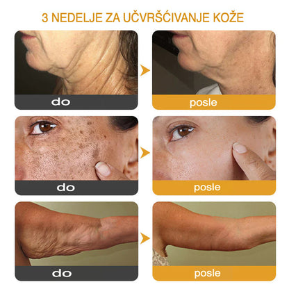 Botox Krema za Učvršćivanje i Smanjenje Bora